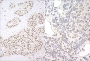 Rabbit anti-PQBP1 Antibody