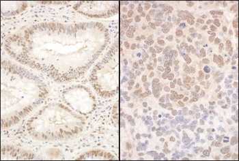 Rabbit anti-PQBP1 Antibody