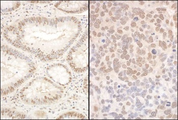 PQBP1 Antibody