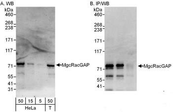 Rabbit MgcRacGAP Antibody