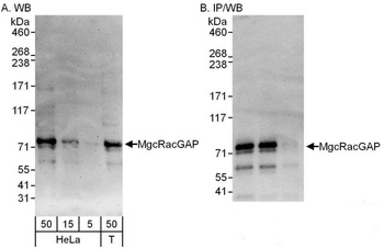 Rabbit MgcRacGAP Antibody