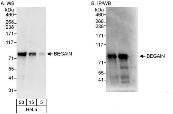 Rabbit BEGAIN Antibody