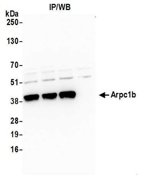 Arpc1b Antibody