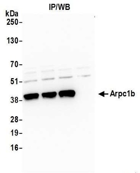 Rabbit anti-Arpc1b Antibody