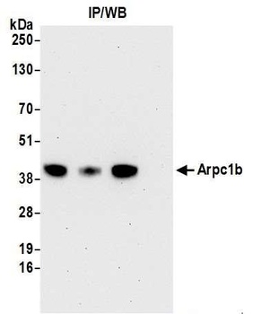 Rabbit anti-Arpc1b Antibody