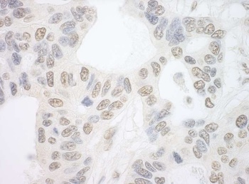 Rabbit anti-PRP6 Antibody