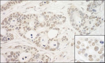 Rabbit anti-PRP6 Antibody
