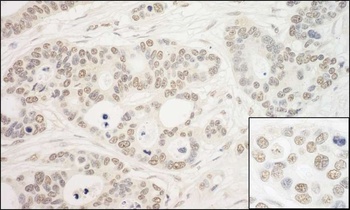 PRP6 Antibody