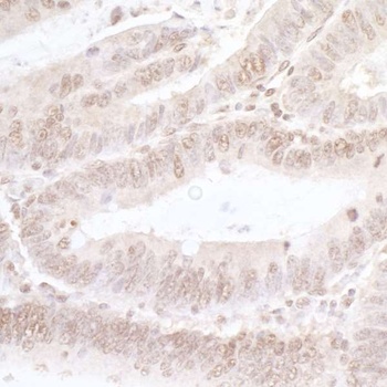 Rabbit NFAT3 Antibody