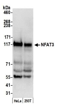 Rabbit NFAT3 Antibody