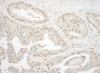 Rabbit NFAT3 Antibody