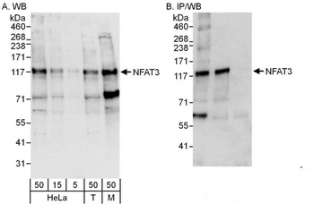 Rabbit NFAT3 Antibody
