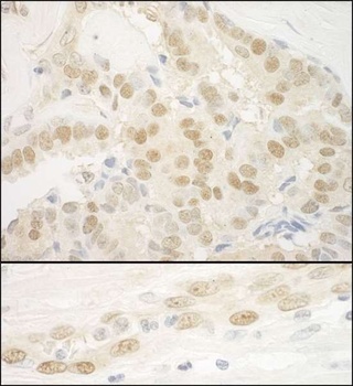 Rabbit anti-MKL2 Antibody