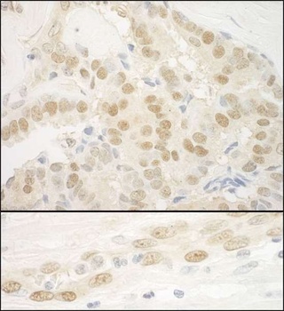 MKL2 Antibody