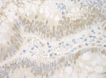Rabbit ARNT Antibody