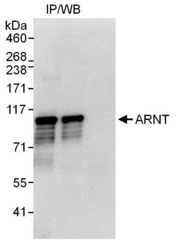 Rabbit ARNT Antibody