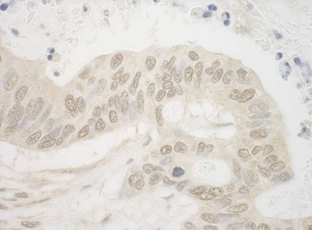 Rabbit ARNT Antibody
