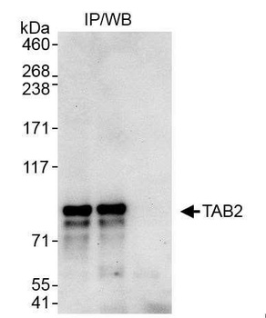 TAB2 Antibody