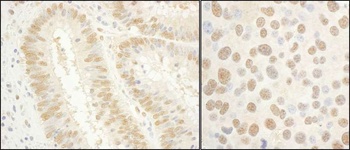 Rabbit anti-GTF2E1/TFIIE-alpha Antibody