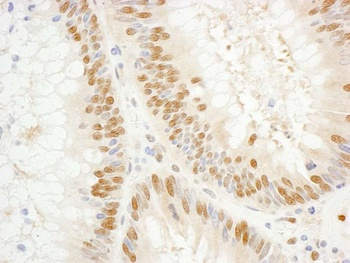 Rabbit anti-GTF2E1/TFIIE-alpha Antibody