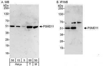 Rabbit PSMD11 Antibody