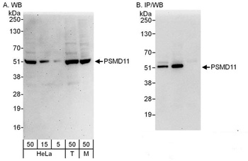 Rabbit PSMD11 Antibody