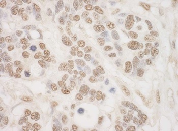 Rabbit MSK2 Antibody