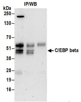 C/EBP beta Antibody