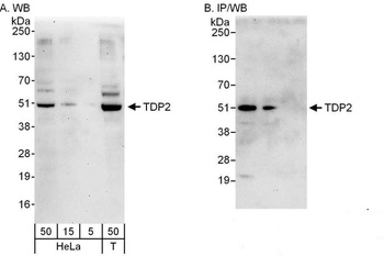 Rabbit TDP2 Antibody