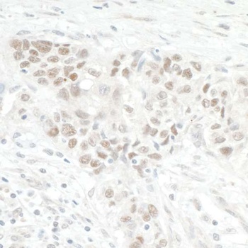 Rabbit anti-NOL12 Antibody