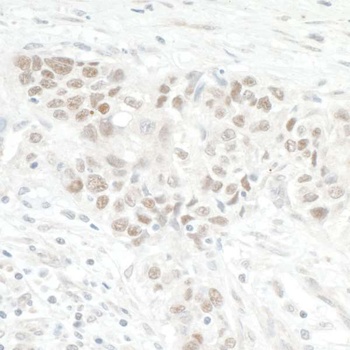 NOL12 Antibody