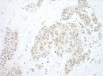Rabbit anti-Pygo2 Antibody