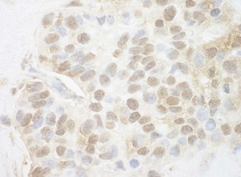 Rabbit anti-Pygo2 Antibody