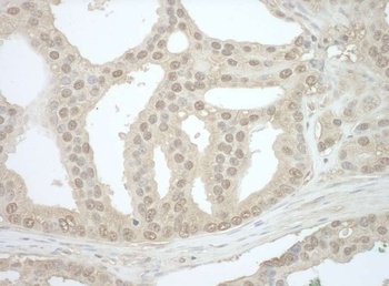Rabbit anti-Bin1 Antibody