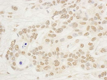 Rabbit anti-NOP132 Antibody