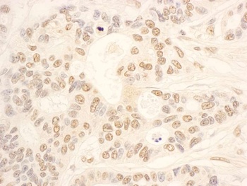 NOP58 Antibody