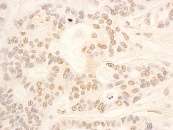 Rabbit anti-NOP58 Antibody