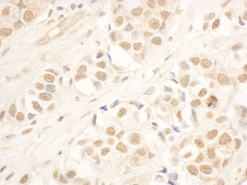 Rabbit anti-NOP58 Antibody