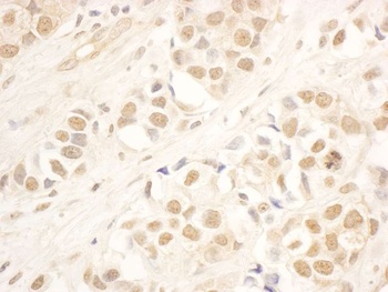 NOP58 Antibody