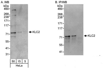 Rabbit KLC2 Antibody