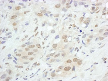 Rabbit JunB Antibody