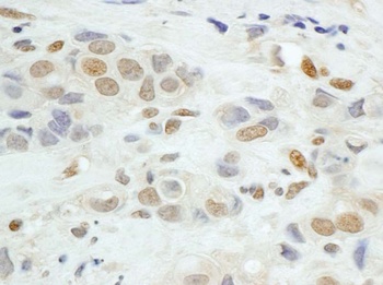 Rabbit JunB Antibody