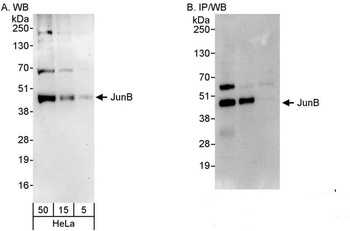 Rabbit JunB Antibody