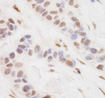 Rabbit anti-TORC3 Antibody