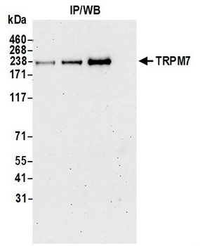 TRPM7 Antibody