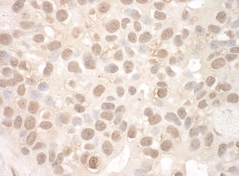 Rabbit anti-EYA2 Antibody