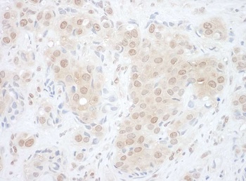 Rabbit anti-EYA2 Antibody