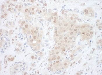 EYA2 Antibody