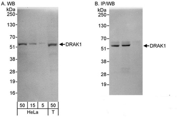 Rabbit anti-DRAK1 Antibody