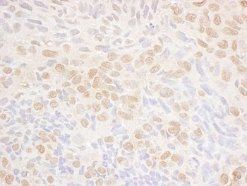 Rabbit anti-DRAK1 Antibody